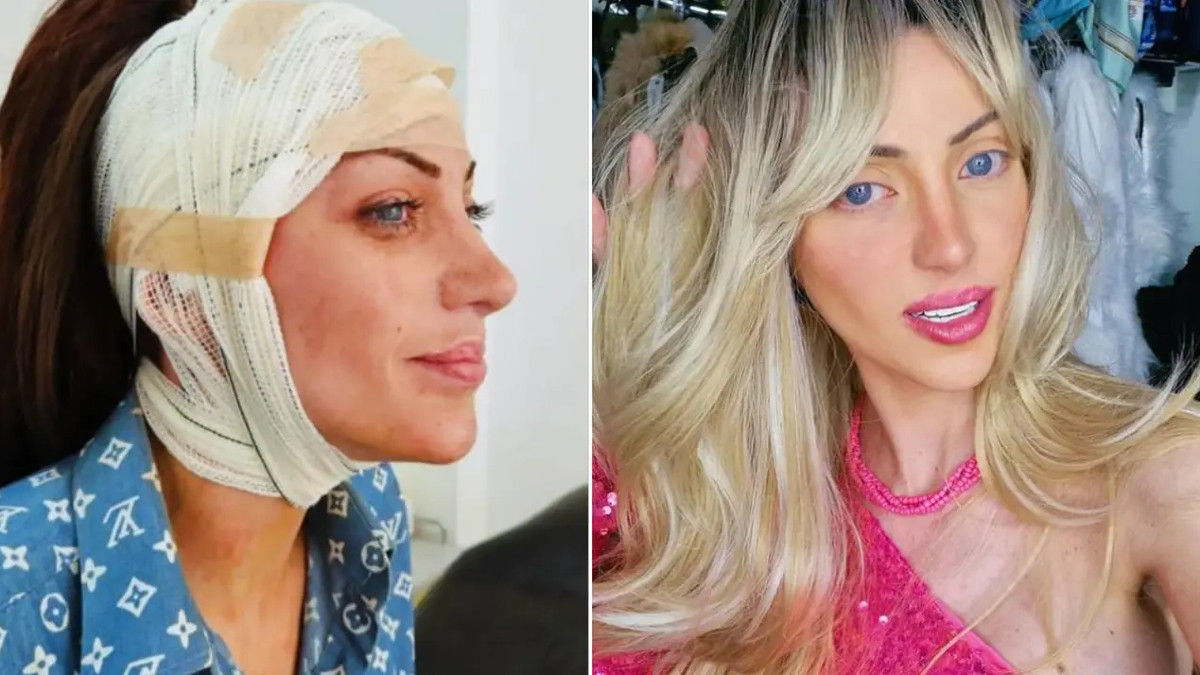 barbie bebege benzemek icin 27 kez ameliyat oldu brezilyali fenomen 31 yasinda hayatini kaybetti qbVa6Uqy.jpg