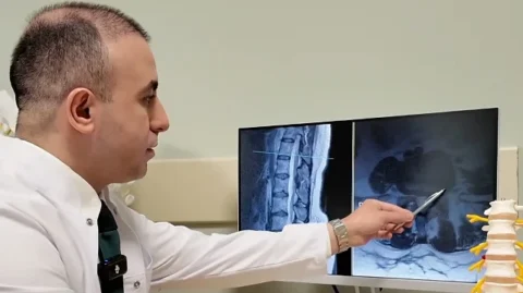 Bel Fıtığı İçin Cerrahiyi Geciktirecek Tedavi Seçenekleri